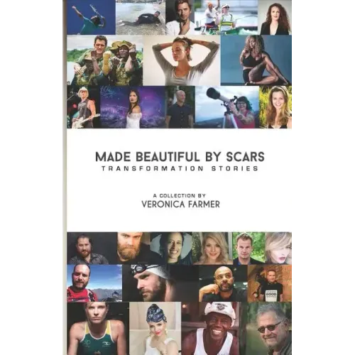 Made Beautiful by Scars: Transformation Stories