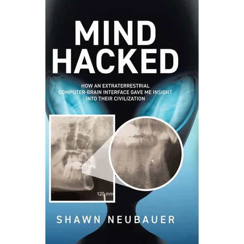 Mind Hacked: How an Extraterrestrial Computer-Brain Interface Gave Me Insight Into Their Civilization