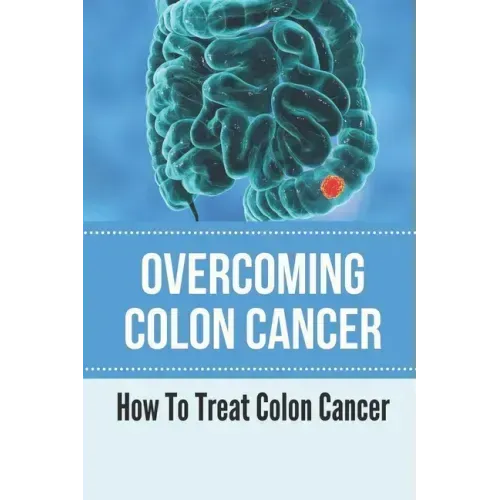 Overcoming Colon Cancer: How To Treat Colon Cancer: Understanding Colorectal Cancer