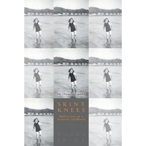 Skint Knees: Reflections on a Scottish Childhood